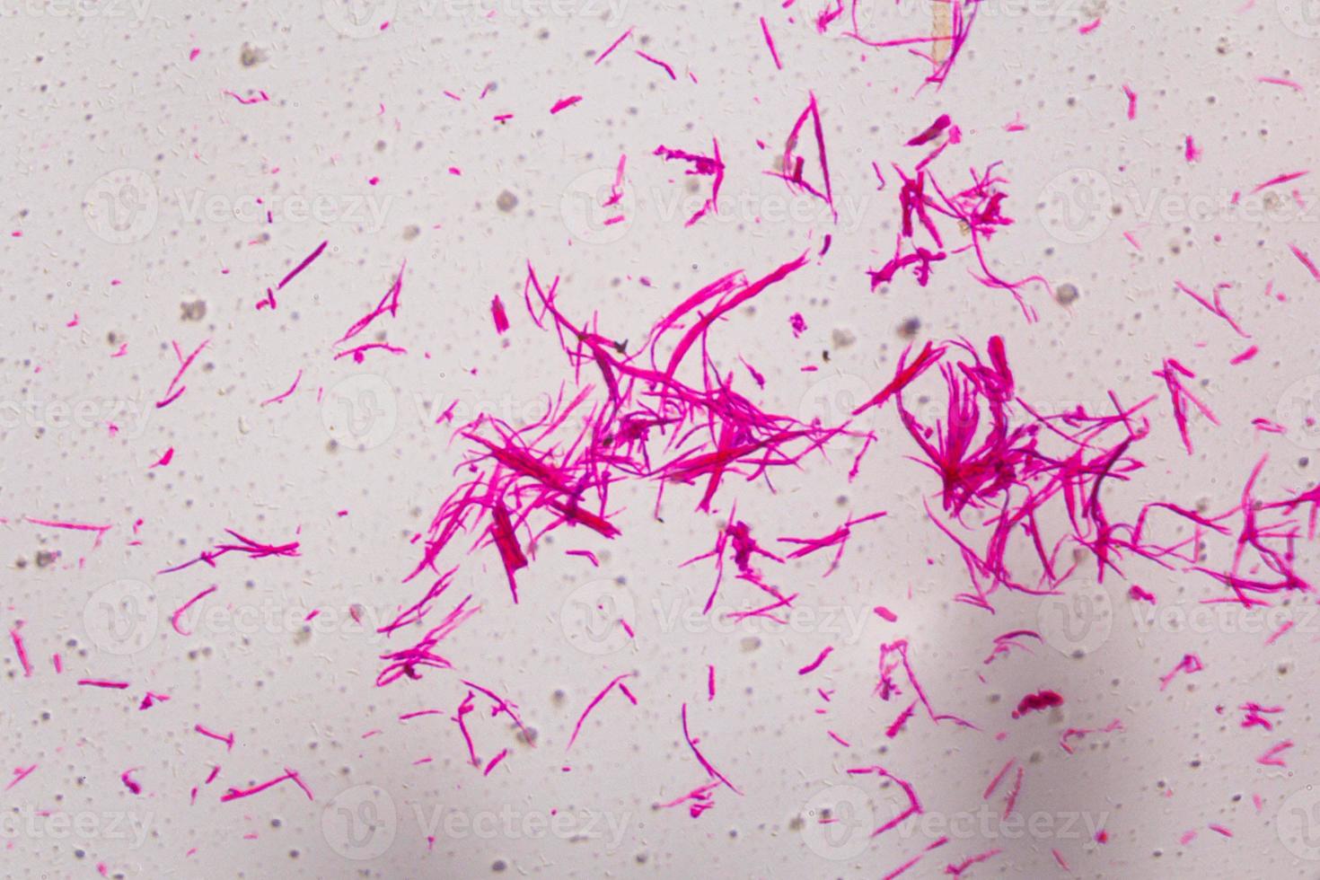 glatte Muskulatur unter dem Mikroskop getrennt - abstrakte rosa Linien auf weißem Hintergrund foto