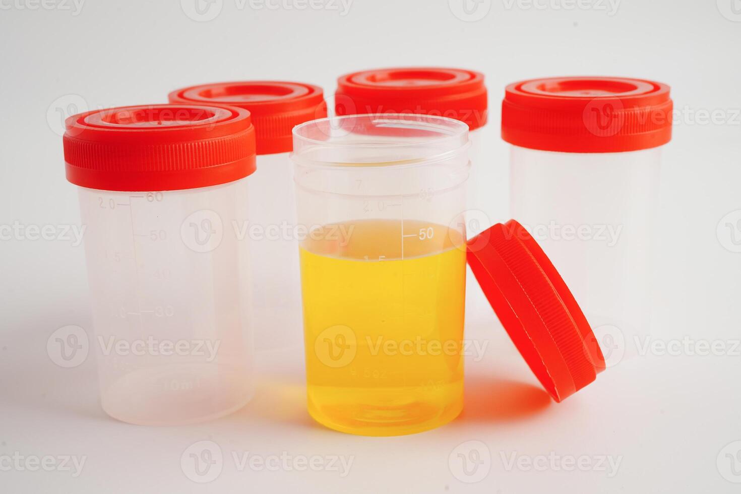 Urinanalyse, Urin Tasse zum prüfen Gesundheit Untersuchung im Labor. foto
