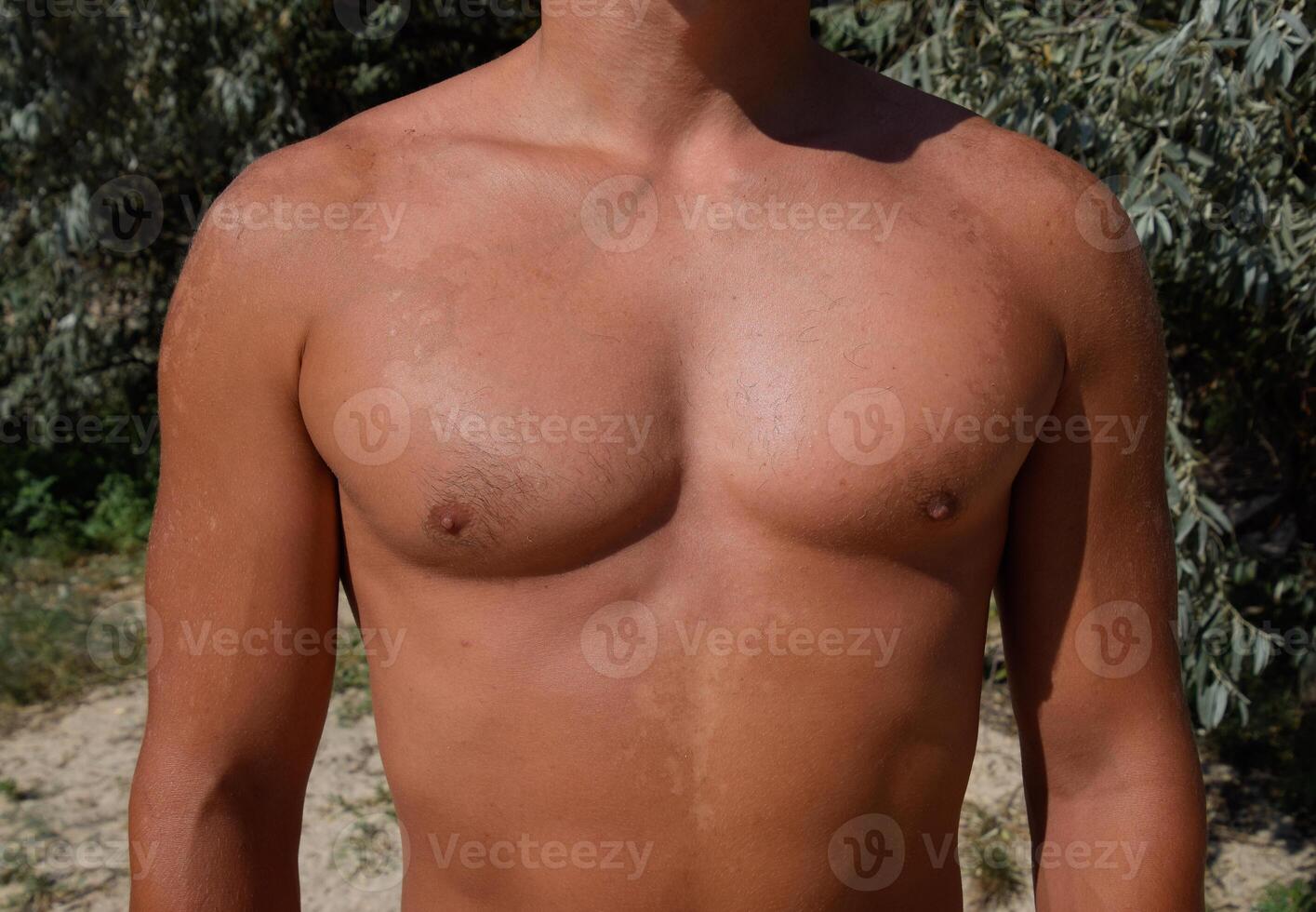 Sonnenbrand auf das Haut von das Truhe und Abdomen von ein Mann. Peeling, Haut schält aus. gefährlich Sonne bräunen foto