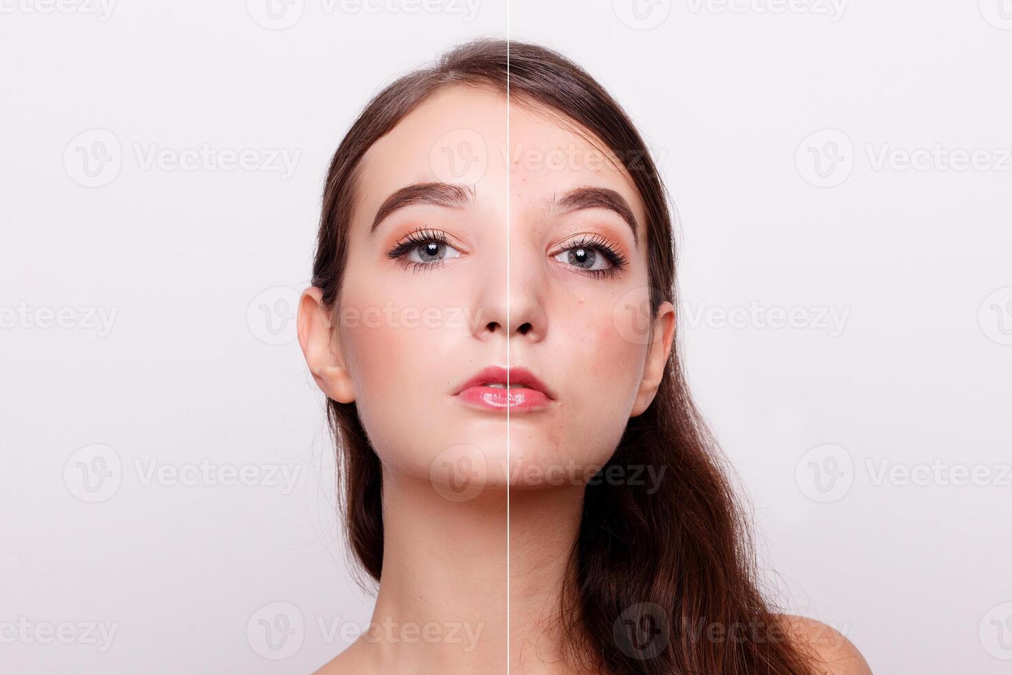 Vor und nach kosmetisch Betrieb foto
