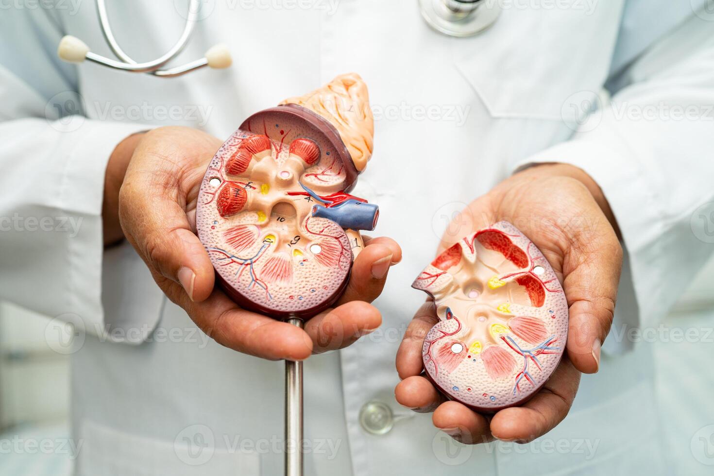 Niere Krankheit, chronisch Niere Krankheit ckd, Arzt mit Mensch Modell- zu Studie und behandeln im Krankenhaus. foto