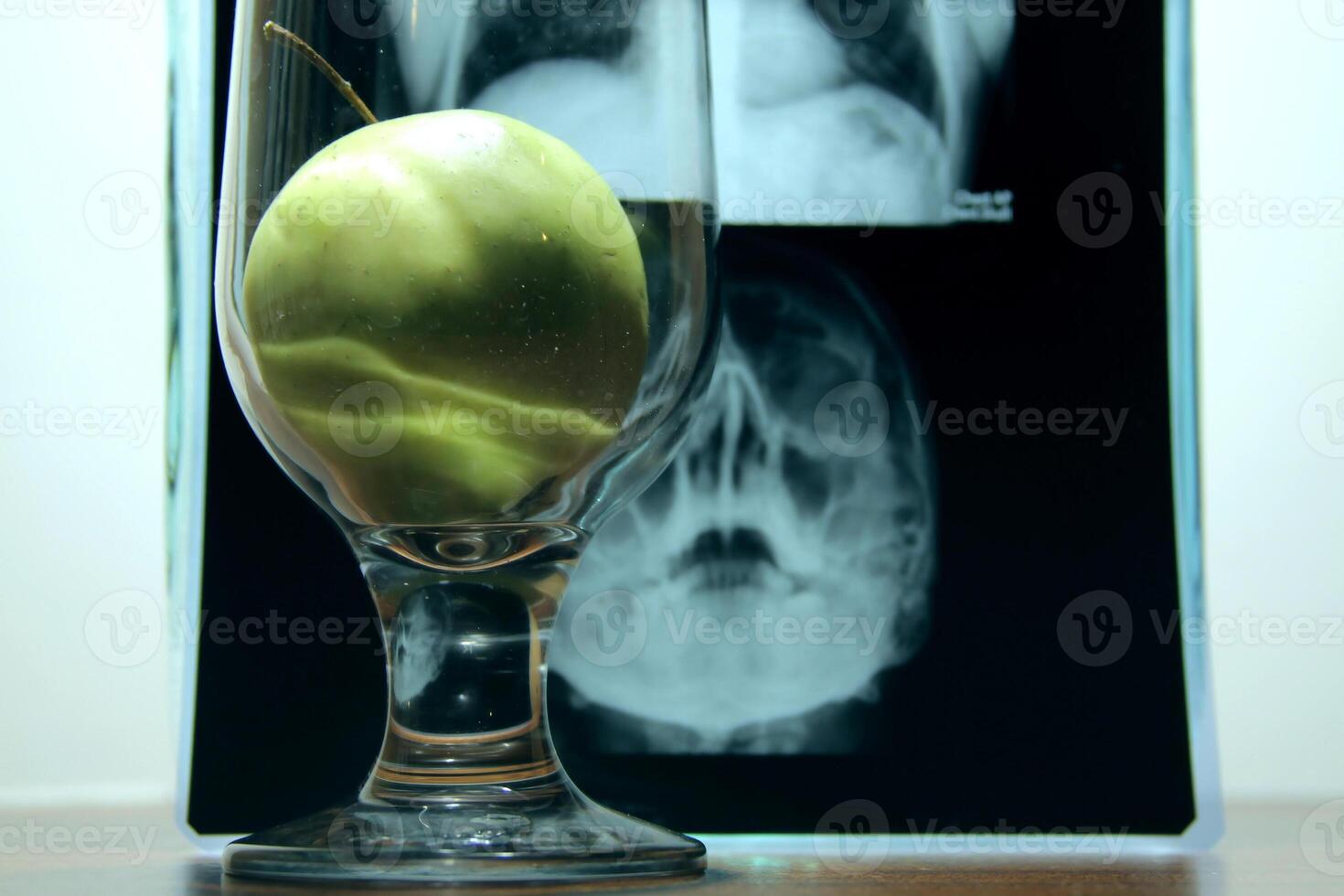 Gesundheit gegen Krankheiten. Apfel im klar Glas Über Radiographie Bild von Gehirn Krankheit Röntgen Analyse foto