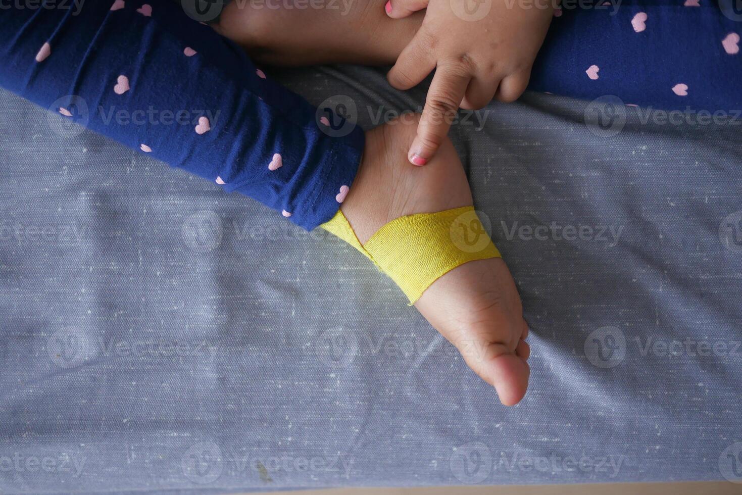 elastisch therapeutisch Gelb Band angewendet zu Kind Bein. Kinesio Taping Therapie zum Verletzung foto