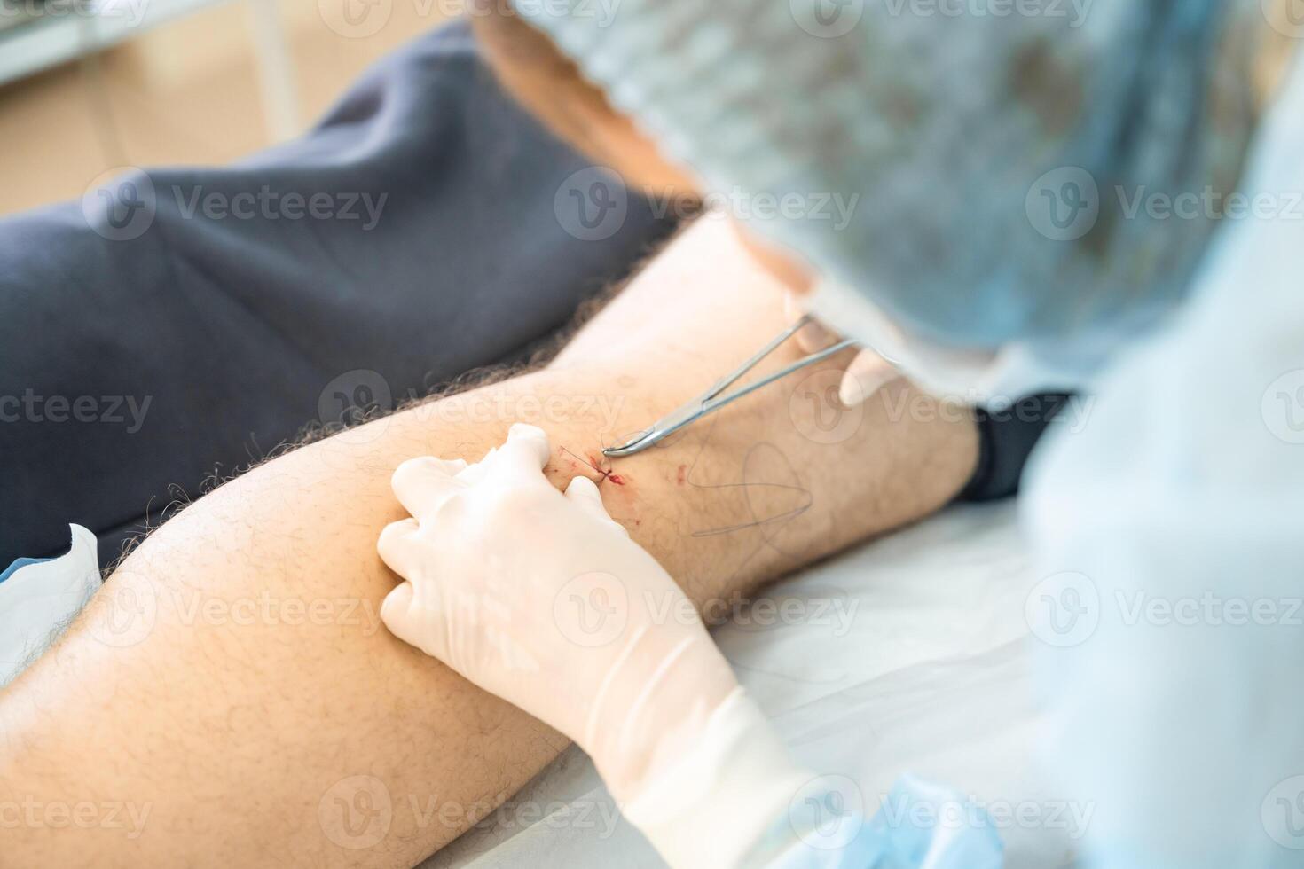 Dermatologe der Chirurg Nähen oben ein Wunde nach Operation, Betrieb Prozess foto
