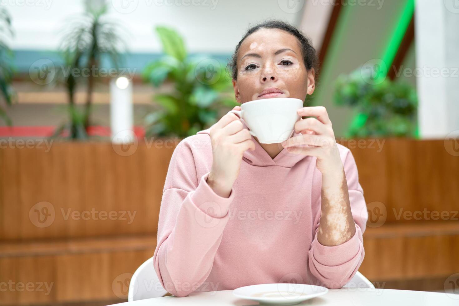 schwarz afrikanisch amerikanisch Frau mit Vitiligo Pigmentierung Haut Problem Innen- gekleidet Rosa Kapuzenpullover foto