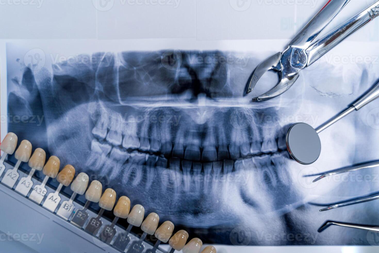 Dental schwenken Röntgen, Prothese und Dental Instrumente. Stomatologie Konzept. foto