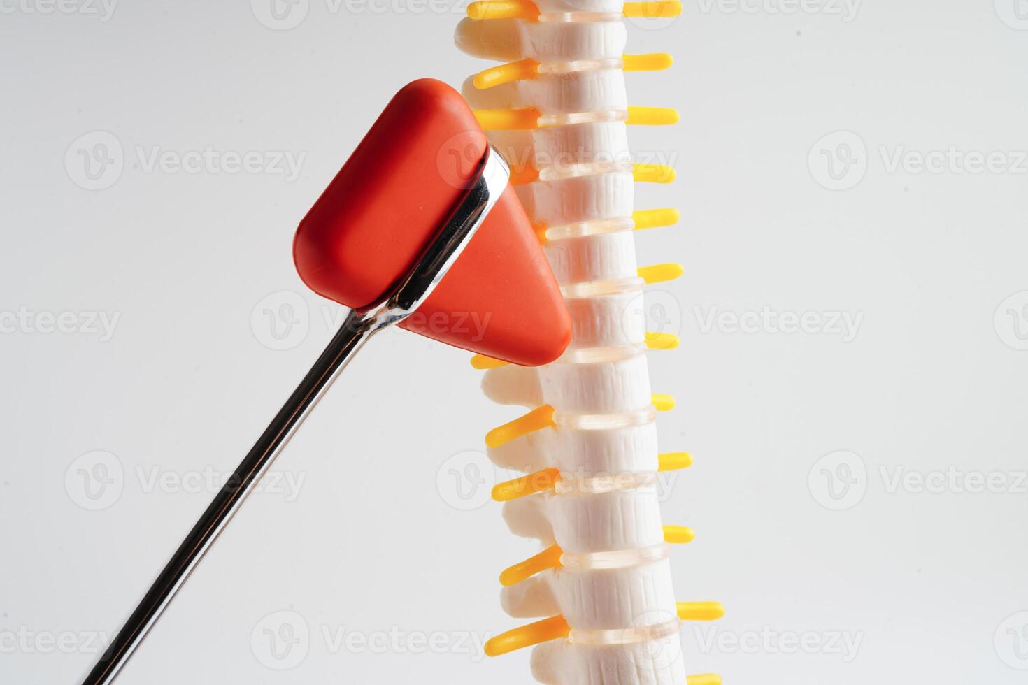 Wirbelsäule Nerv und Knochen mit Knie Reflex Hammer, Lendenwirbelsäule Rücken versetzt herniert Rabatt Fragment, Modell- zum Behandlung medizinisch im das orthopädisch Abteilung. foto