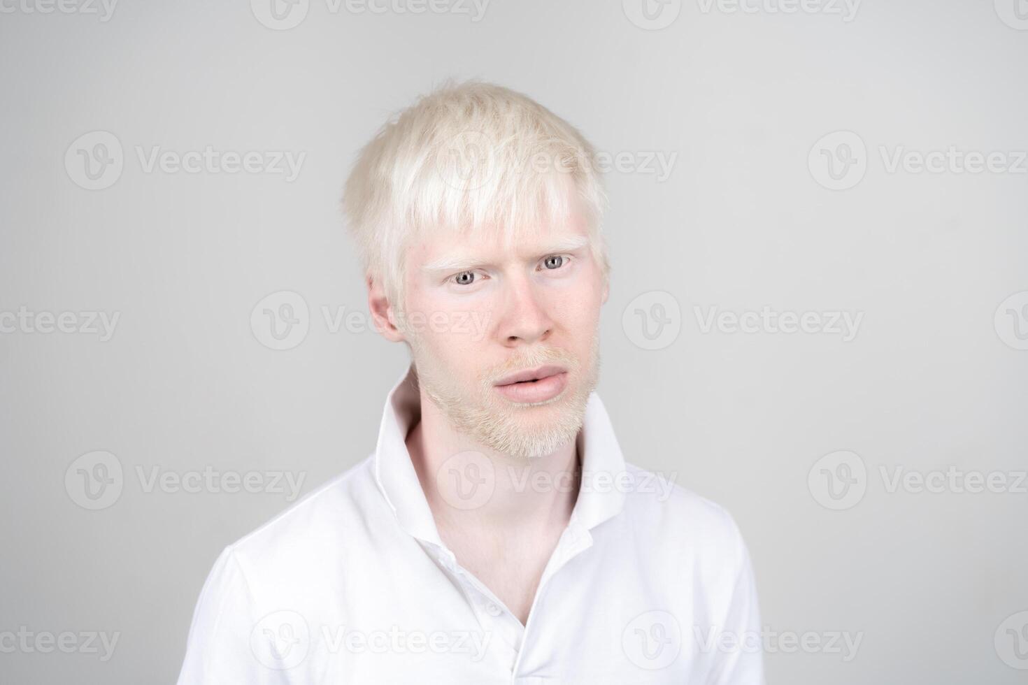 Porträt von ein Albino Mann im Studio gekleidet T-Shirt isoliert auf ein Weiß Hintergrund. abnormal Abweichungen. ungewöhnlich Aussehen foto