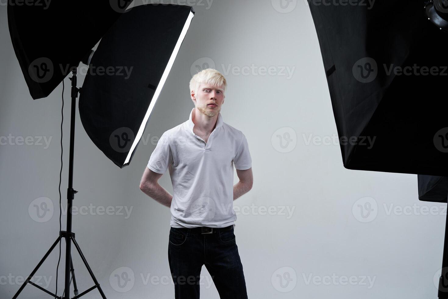 Albinismus Albino Mann im Studio gekleidet T-Shirt isoliert auf ein Weiß Hintergrund. abnormal Abweichungen. ungewöhnlich Aussehen foto