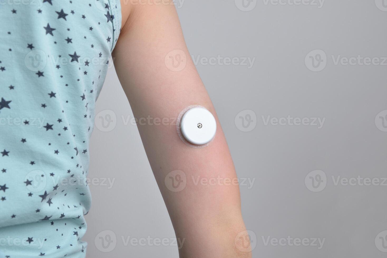 Kinder Hand mit Weiß Sensor zum kontinuierlich Glucose Überwachung. Konzept von Gesundheit, Diabetes Management, medizinisch Technologie, und Überwachung Lösungen foto
