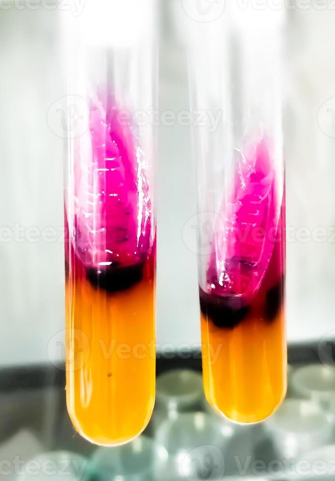 Salmonellen Erkennung Methode durch mit verdreifachen Zucker Eisen oder tsi Agar im Mikrobiologie Labor. foto