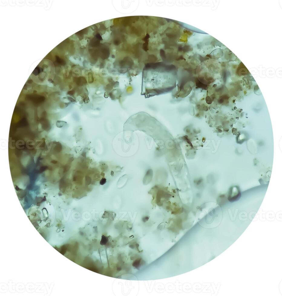 Schistosoma Parasit Eizellen im Mensch Urin Probe unter Mikroskop. Urin- Parasit foto