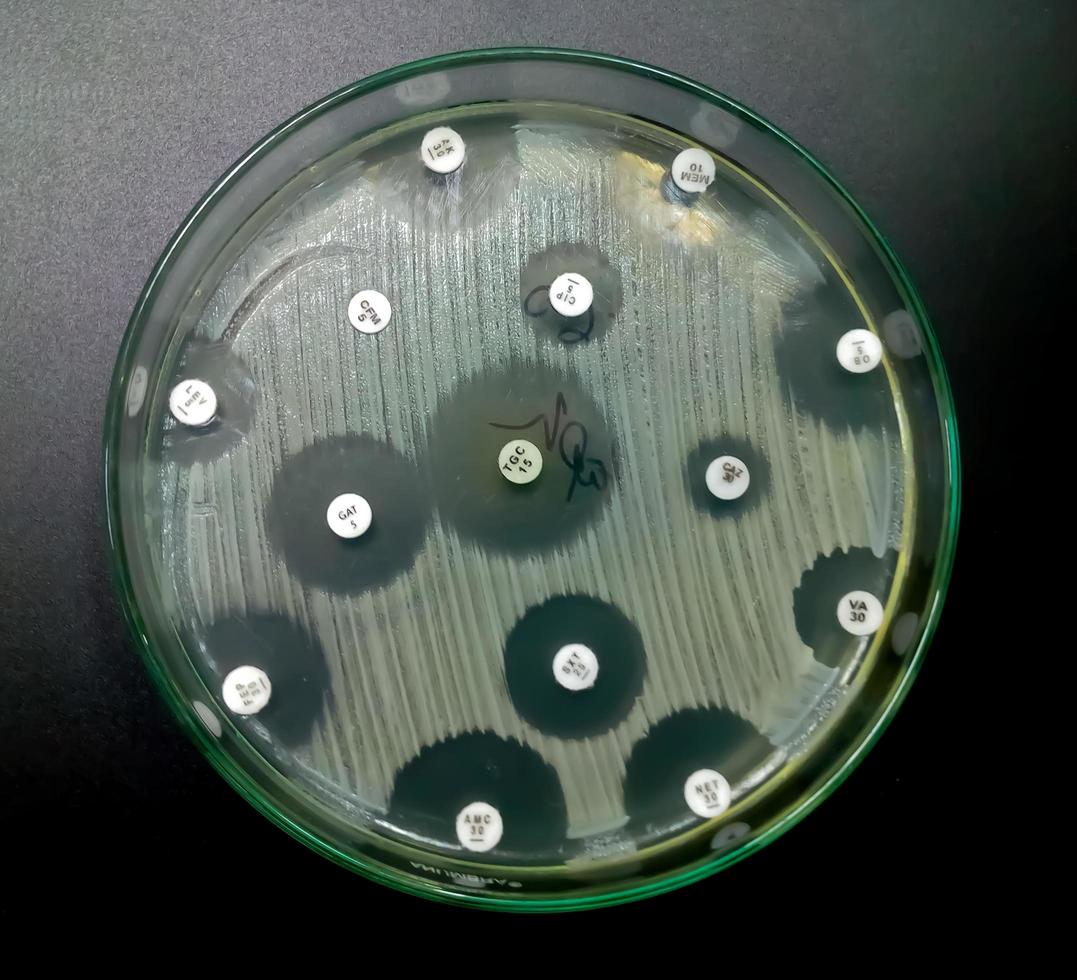 antimikrobielle Empfindlichkeitsprüfung in Petrischale. Antibiotikaresistenztest von Bakterien foto