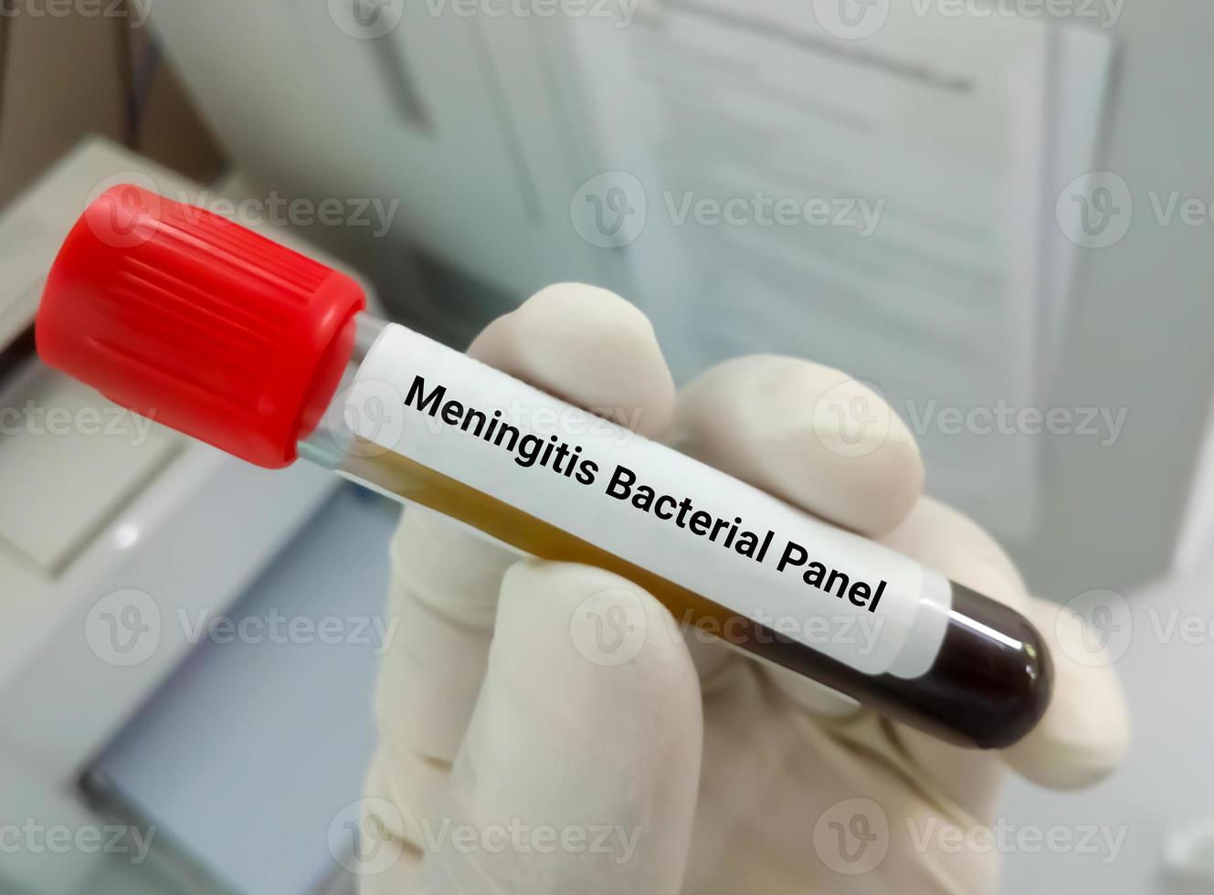 Blutprobenröhrchen für den Meningitis-Bakterien-Panel-Test. Diagnose von Hirninfektionen medizinisches Konzept, Meningitis, Enzephalitis foto