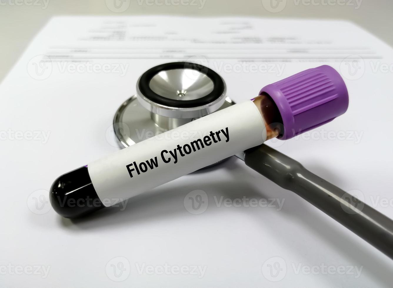 Blutröhrchen mit Probe für den Durchflusszytometrietest. um den Zelltyp in einer Blutprobe zu erkennen, zu identifizieren und zu zählen. foto