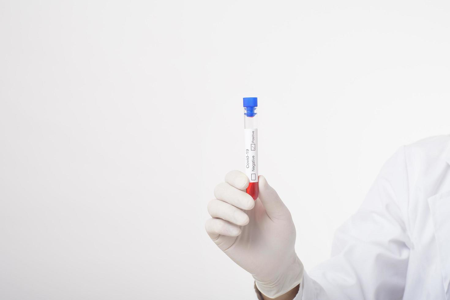 Arzt hält infizierten Covid-19-Bluttest auf weißem Hintergrund foto