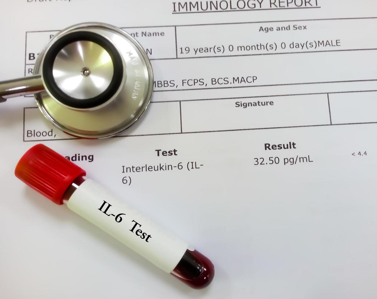 Blutprobenröhrchen isoliert auf abnormal hohen Interleukin-6- oder il-6-Testbericht. Testbericht eines Covid-19-positiven Patienten. foto