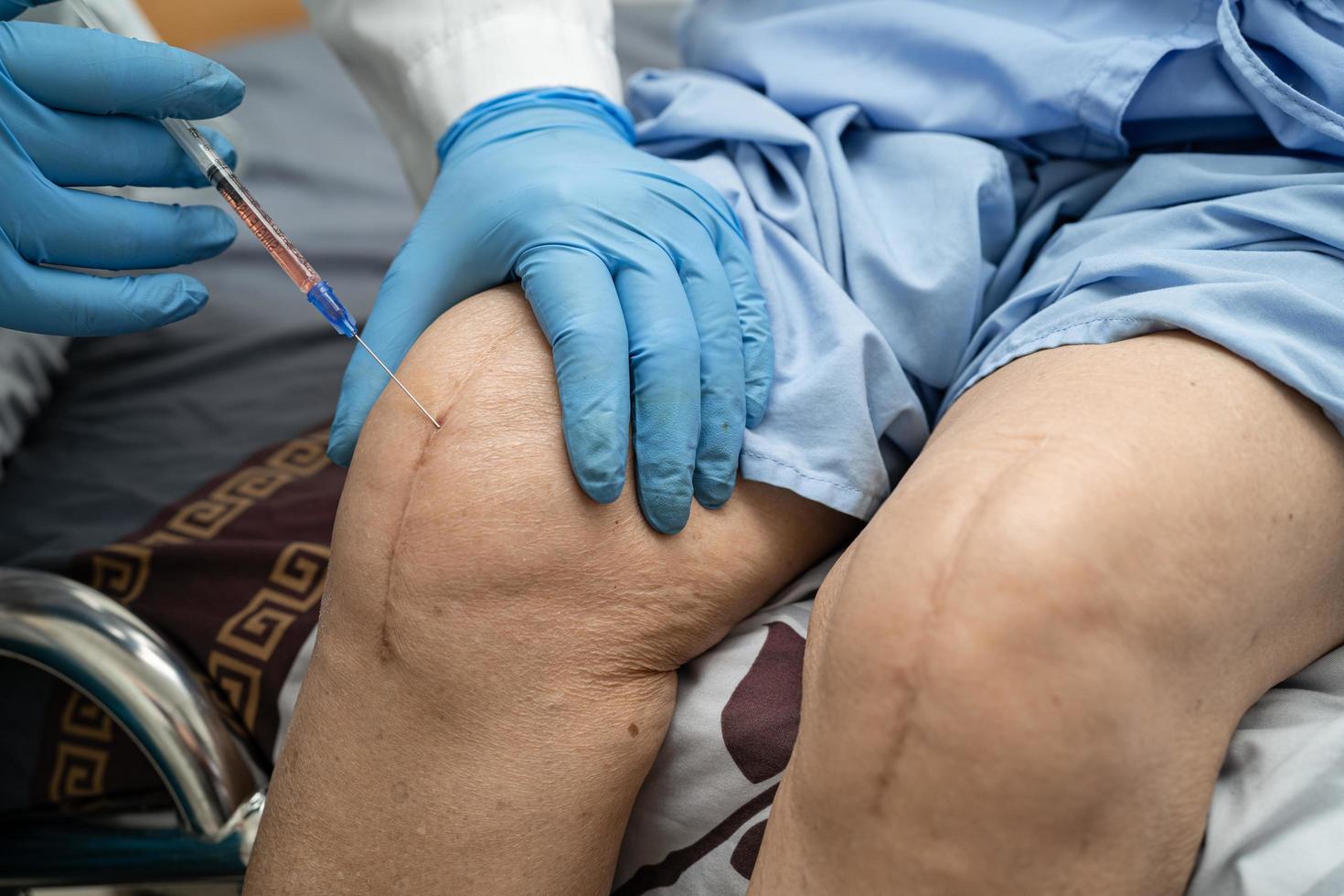 Asiatischer Arzt injiziert blutplättchenreiches Hyaluronsäureplasma in das Knie einer älteren Frau, um schmerzfrei zu gehen. foto