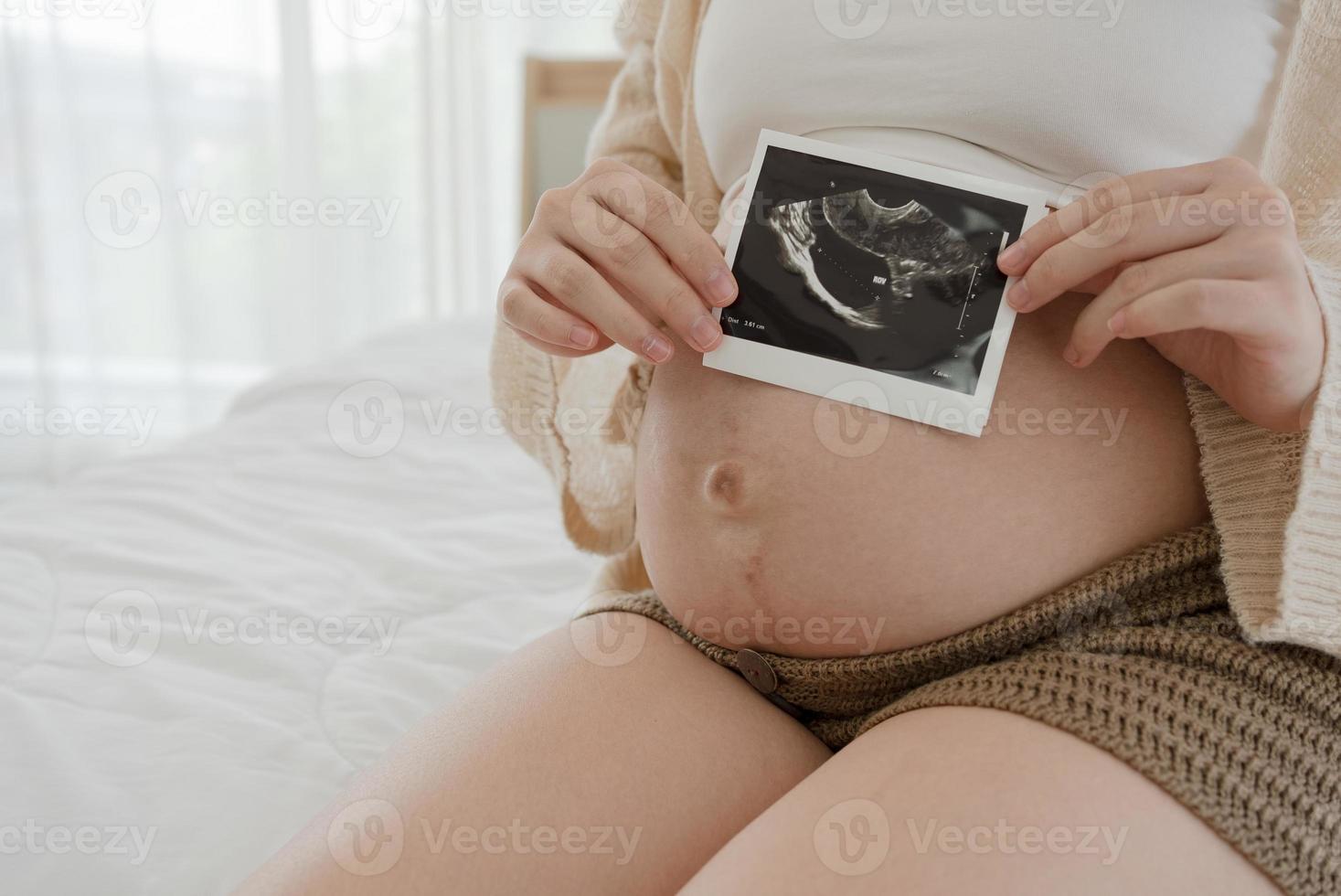 Nahaufnahme einer schwangeren Frau, die ein Ultraschallbild des Babys im Bauch zeigt foto