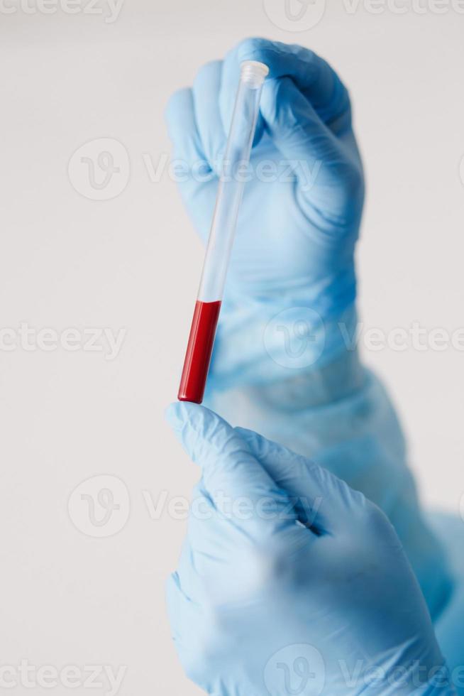 Nahaufnahme der Hand des Arztes, die eine Blutprobe hält. medizinische Ausrüstung. Bluttest. ein arzt, der persönliche schutzausrüstung trägt, einschließlich maske, brille und anzug, um eine covid-19-coronavirus-infektion zu schützen. foto