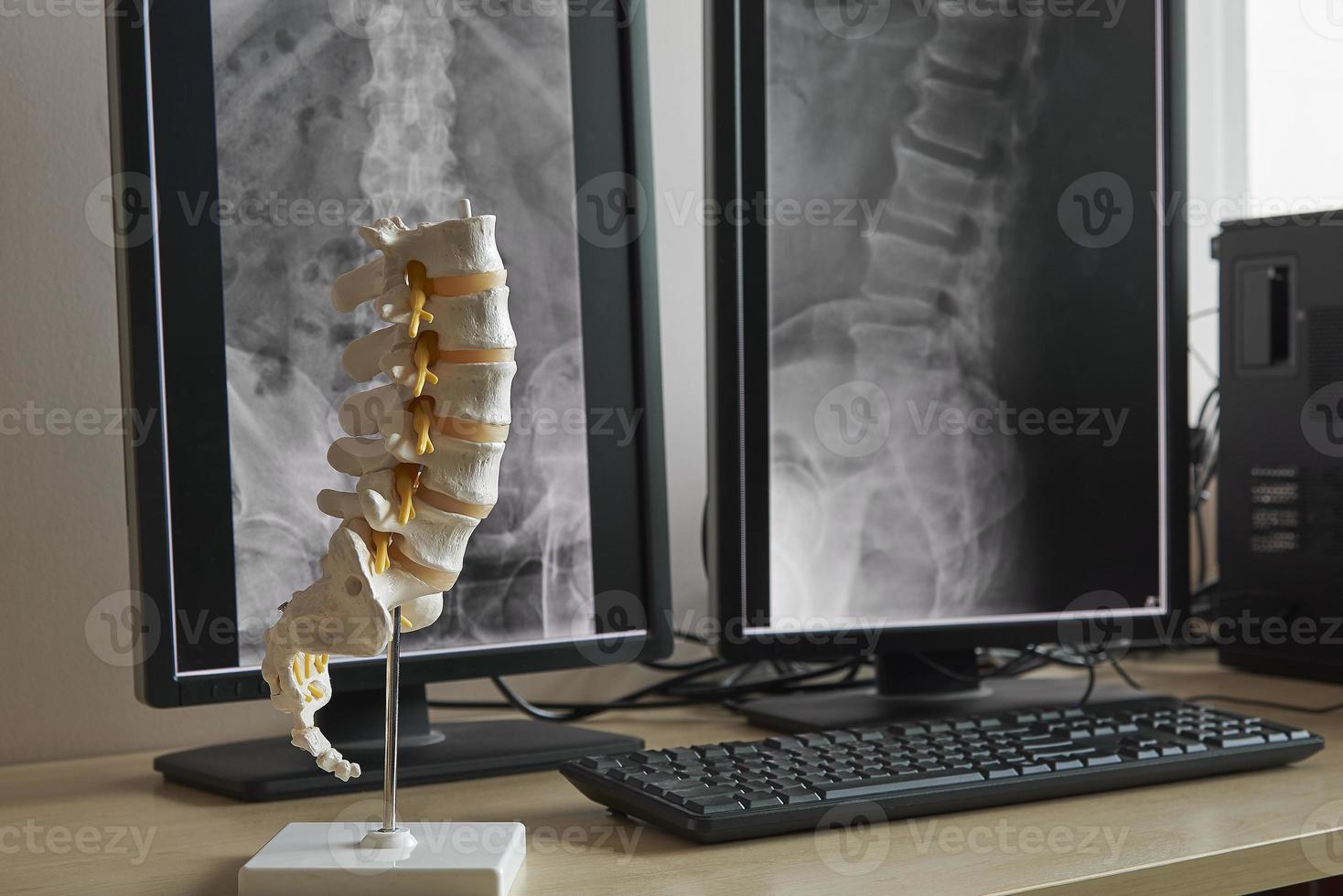 Modell der menschlichen Lendenwirbelsäule und Hintergrund von Röntgenstrahlen der Lendenwirbelsäule foto