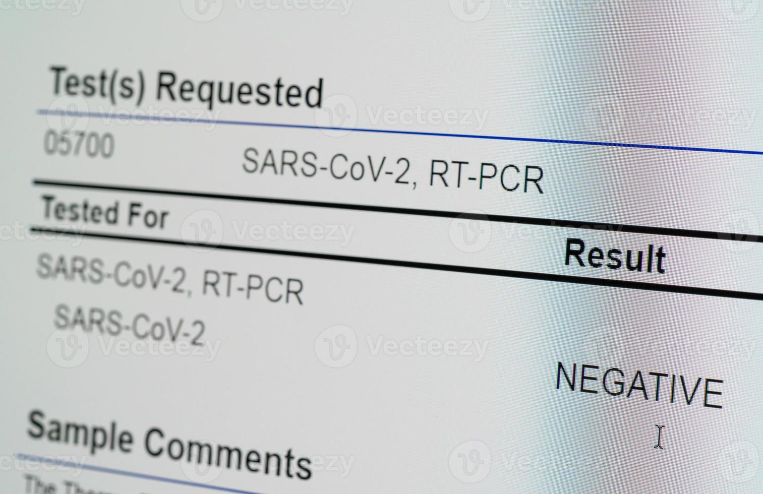 ansicht des computerbildschirms, die das ergebnis des pcr-tests für covid-19 als negativ zeigt foto