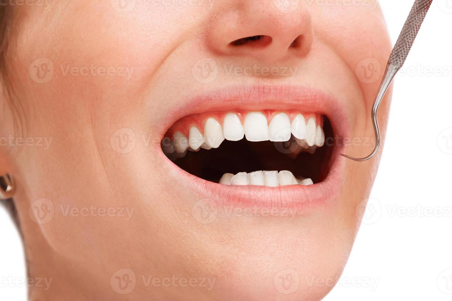 weiblicher Mund mit weißen Zähnen foto