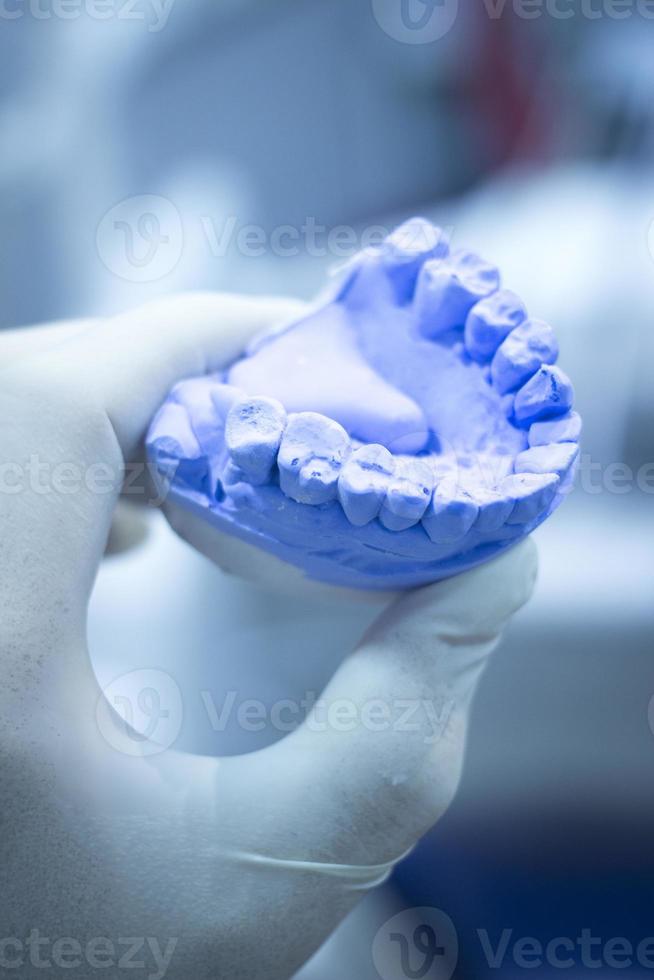 Zahnform Zahnarzt Ton Zähne Keramikplatte Modell gegossen foto