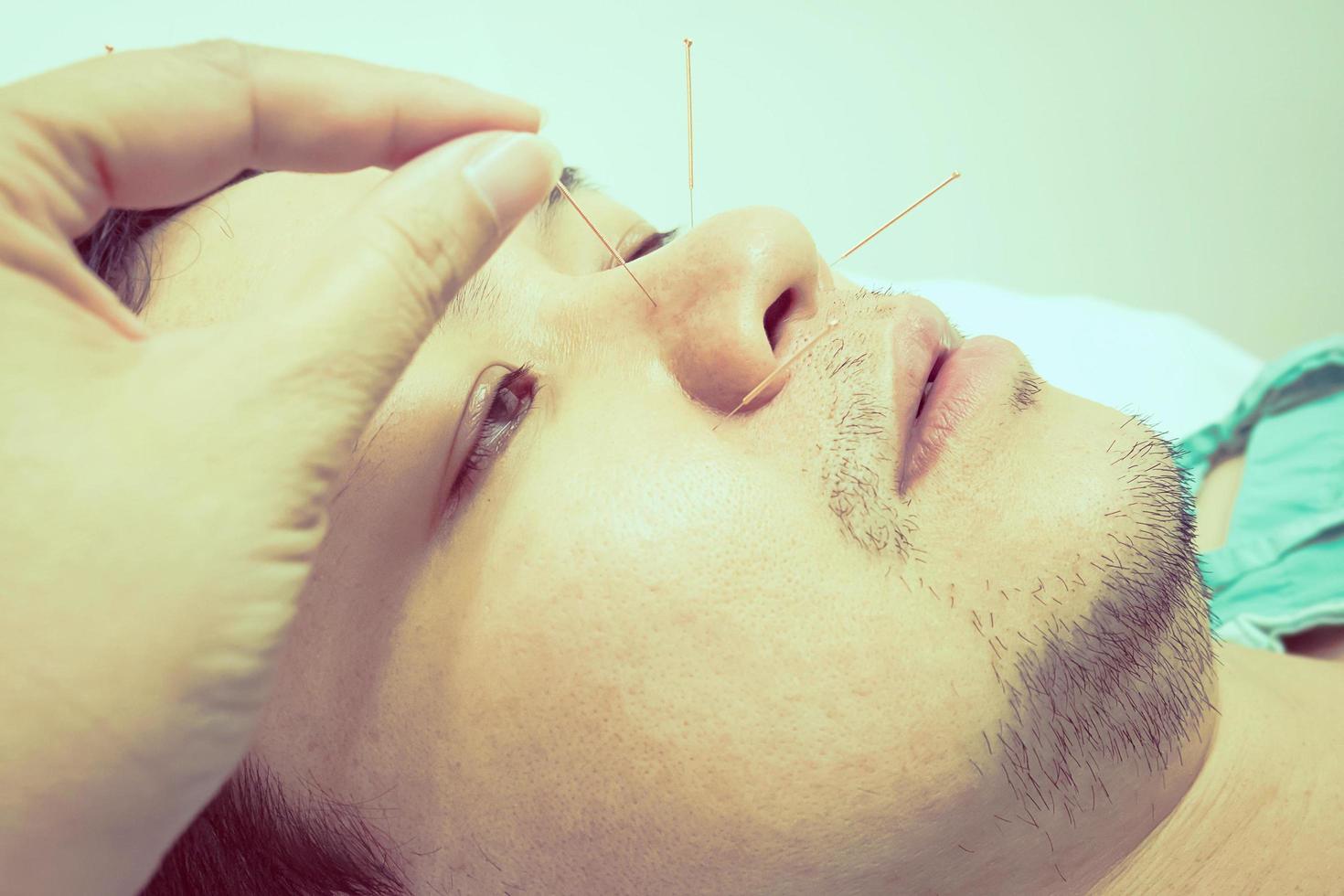 Foto im Vintage-Stil eines selektiv fokussierten asiatischen Mannes erhält eine Akupunkturbehandlung