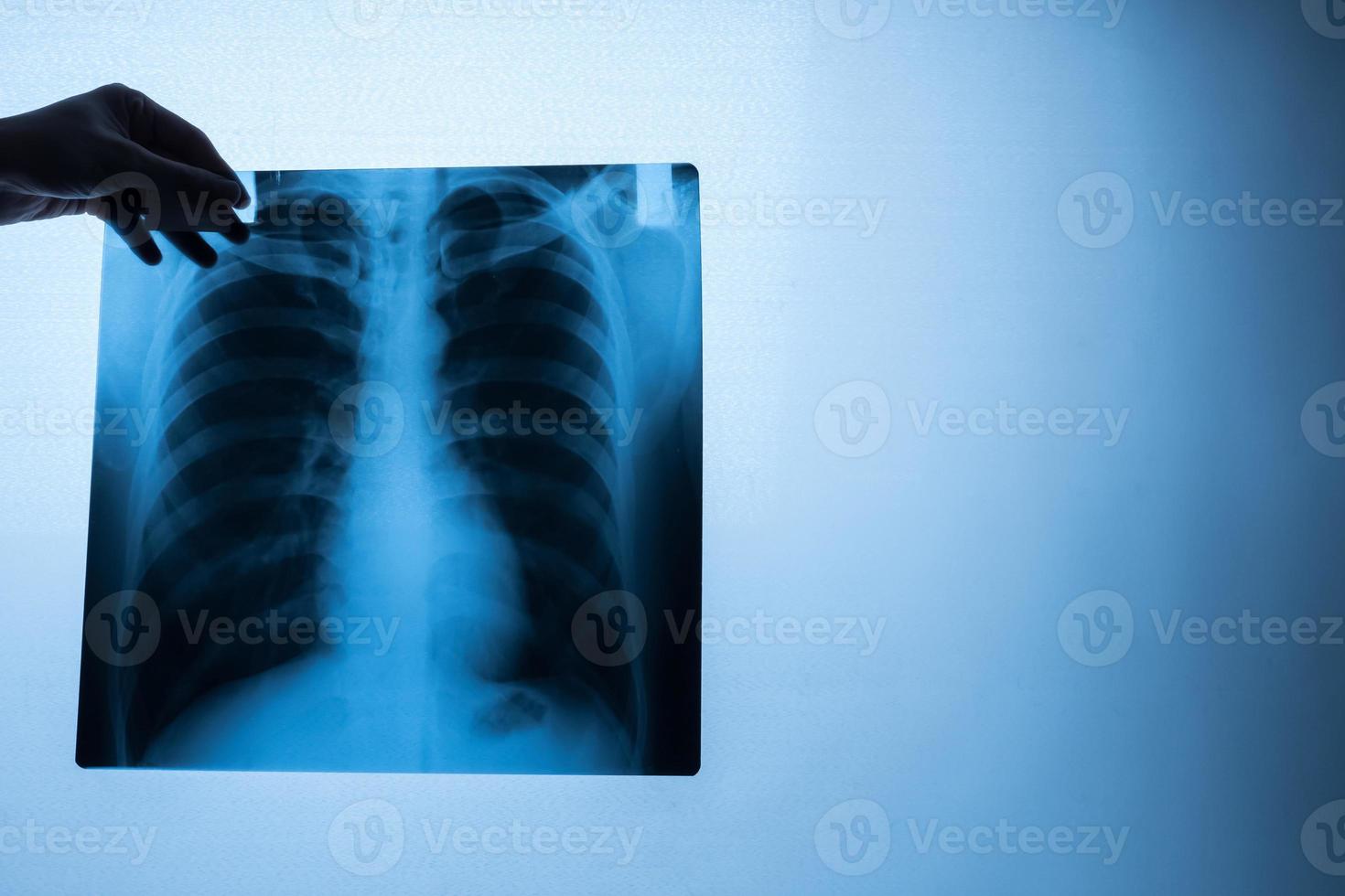 facharzt untersucht röntgenfilm des patienten. foto
