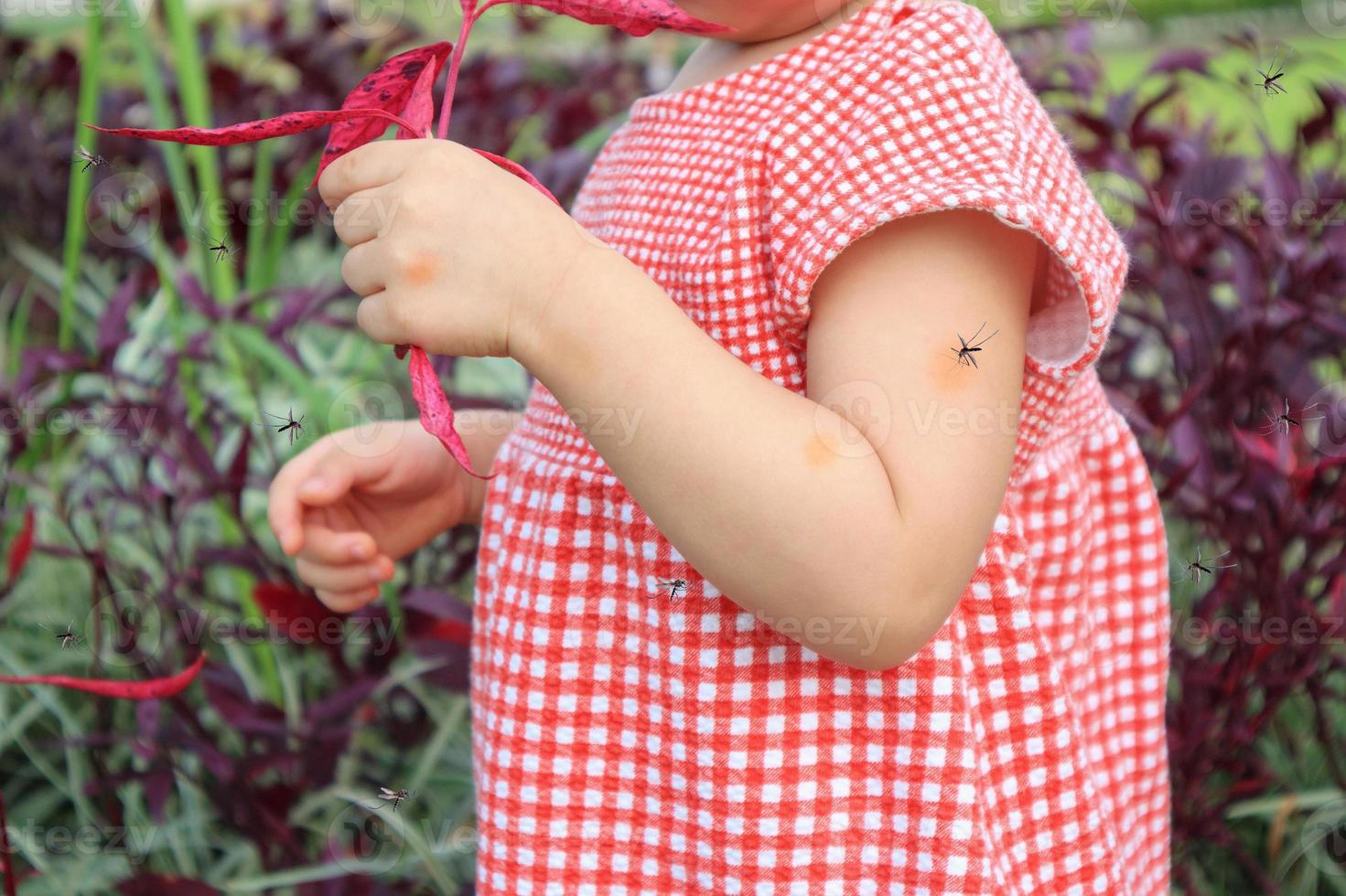 süßes asiatisches baby hat hautausschlag und allergie durch mückenstich und saugt blut beim spielen im freien foto