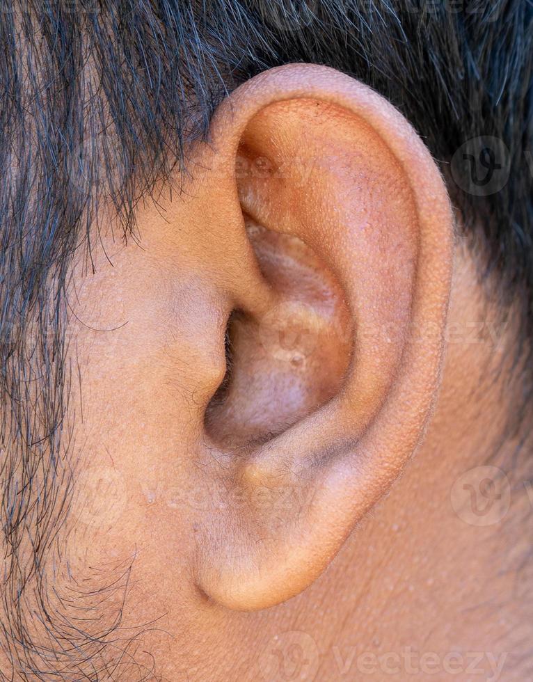 Nahaufnahme des menschlichen Ohrs oder Ohr-HNO-Arztkontrolle foto