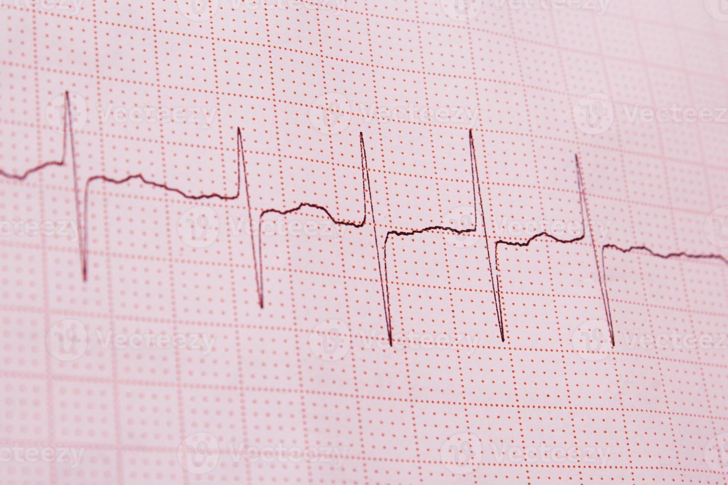 EKG-Druck foto
