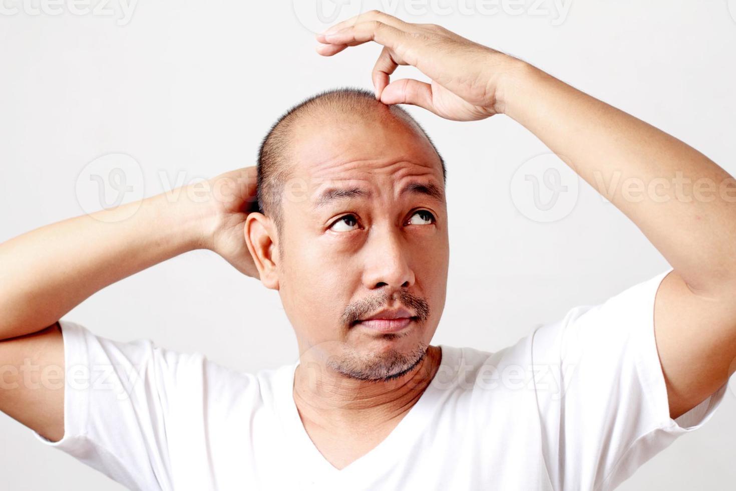 kahlköpfiger Mann, der Kopf hält und Haarsträhne umklammert foto
