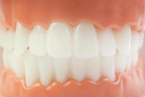 das Zahnmodell auf weißem Hintergrund für zahnärztliche Inhalte. foto