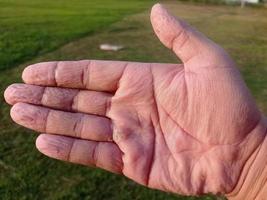 Die Haut der Handflächen ist faltig und nass vom Wasser, zu lange in Wasser getaucht. foto