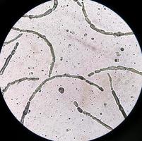 Mikrofotografie mit Hyphen von Dermatophyten, Nagelkratzen für Pilztest foto