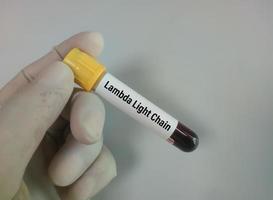 Blutprobe für den Lambda-Leichtkettentest. foto