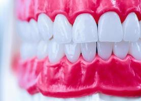 menschlicher Kiefer mit Zähnen und Zahnfleisch Anatomiemodell