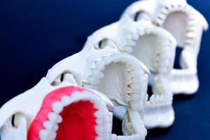 Zahnarzt kieferorthopädische Zahnmodelle foto