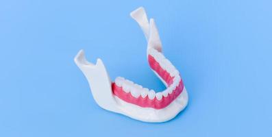 menschlicher Unterkiefer mit Anatomiemodell von Zähnen und Zahnfleisch