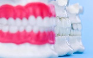 menschliche Kiefer mit Zähnen und Zahnfleischanatomiemodellen