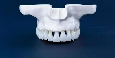 menschlicher Oberkiefer mit Zähnen foto