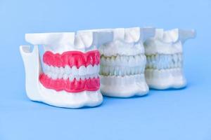 menschliche Kiefer mit Zähnen und Zahnfleischanatomiemodellen