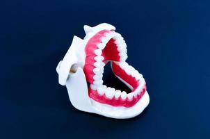 Kieferorthopädisches Zahnmodell des Zahnarztes foto