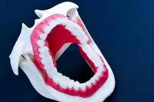 Kieferorthopädisches Zahnmodell des Zahnarztes foto