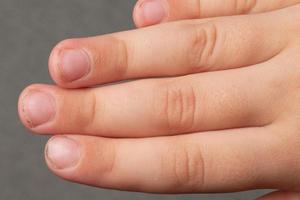 Die schmutzigen und schlampig geschnittenen Nägel, Finger und Zehennägel des Kindes aus nächster Nähe. foto