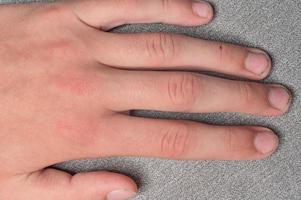 Schmutzige und lange Nägel mit Graten, Fingern und Fingernägeln eines Kindes auf grauem Hintergrund. foto