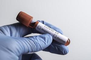 Coronavirus-Probenfläschchen auf weißem Hintergrund foto
