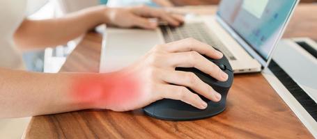 Frauenhand mit ergonomischer Computermaus, Handgelenkschmerzen vorbeugen, weil lange gearbeitet wird. de quervain s tenosynovitis, kreuzungssymptom, karpaltunnelsyndrom oder bürosyndromkonzept foto